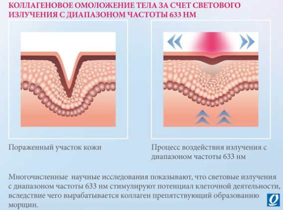 ВСЕ О КОЛЛАГЕНАРИИ - Статьи - Тонус Центр - Екатеринбург